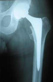 image-12 - Strong Health